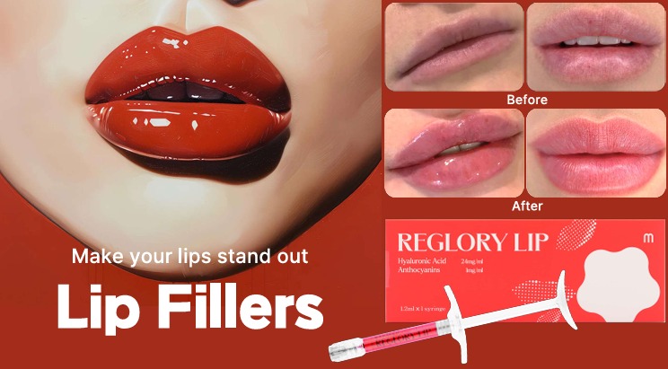 Reglory lip fillers